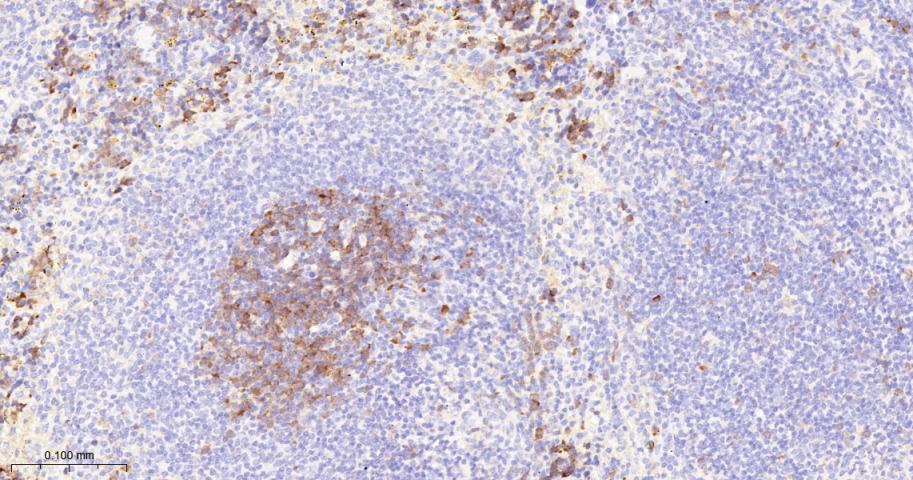 周期素依赖性激酶1重组兔单抗