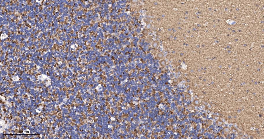 突触小泡蛋白P38重组兔单抗