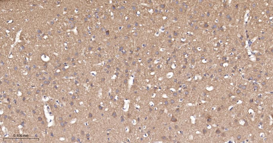 泛素结合蛋白P62重组兔单抗