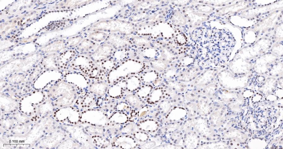 抑癌基因SNF2β重组兔单抗