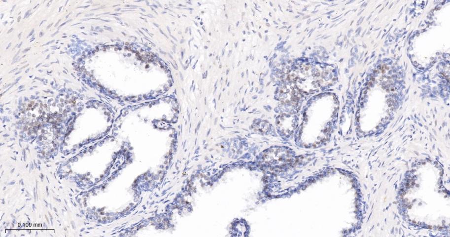 抑癌基因SNF2β重组兔单抗