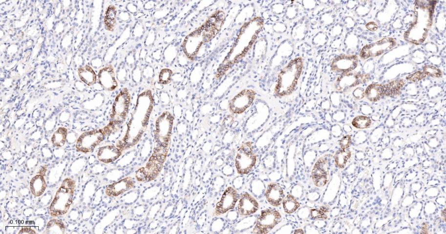 神经细胞粘附分子配体1重组兔单抗