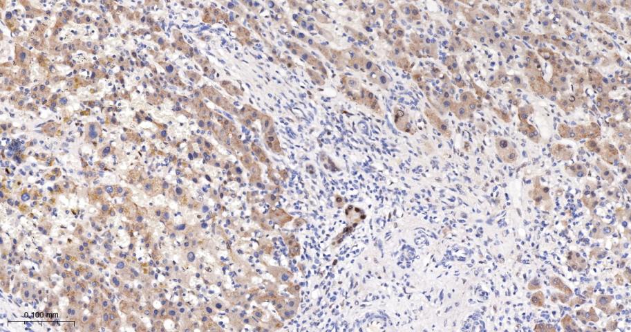 泛素结合蛋白P62重组兔单抗