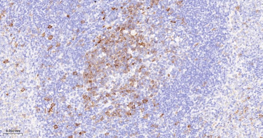 周期素依赖性激酶1重组兔单抗