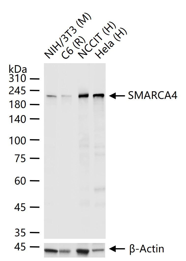 抑癌基因SNF2β重组兔单抗