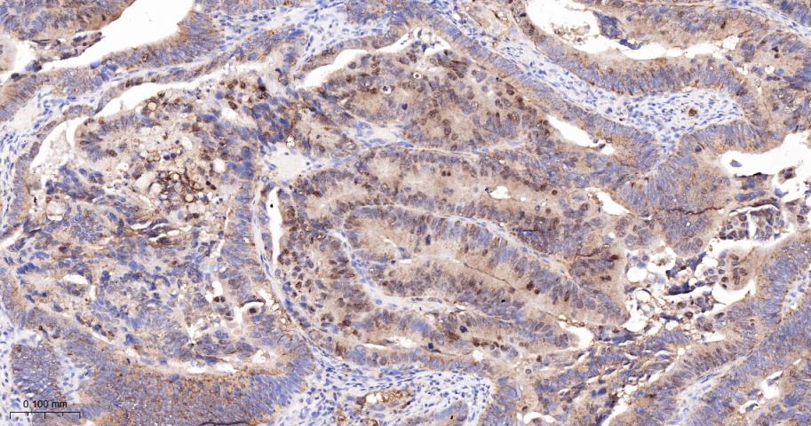 泛素结合蛋白P62重组兔单抗