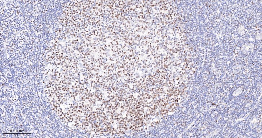 抑癌基因SNF2β重组兔单抗