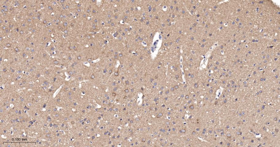 泛素结合蛋白P62重组兔单抗