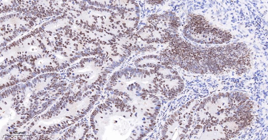 抑癌基因SNF2β重组兔单抗