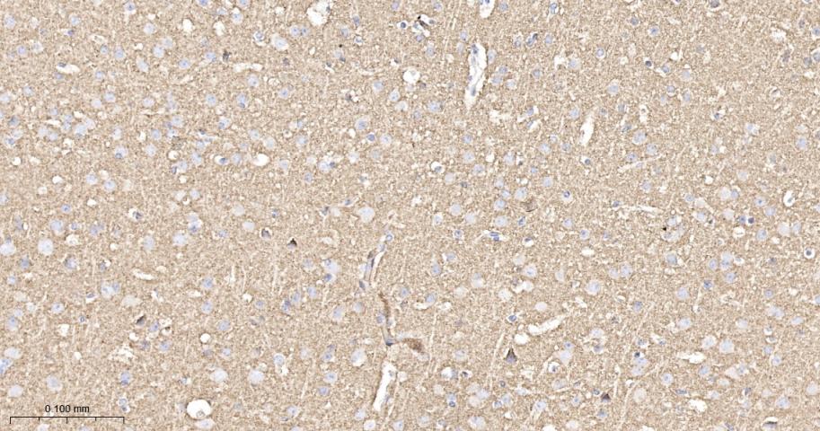 突触小泡蛋白P38重组兔单抗