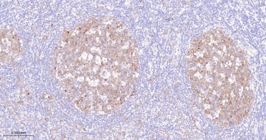 周期素依赖性激酶1重组兔单抗