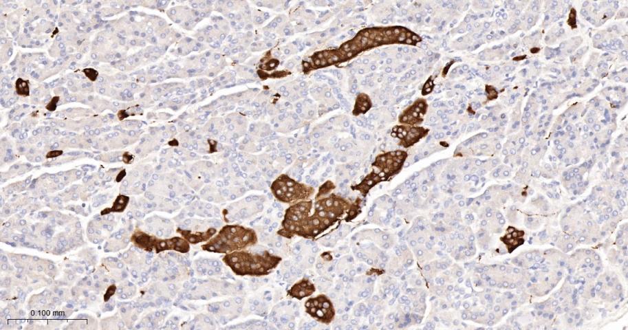 突触小泡蛋白P38重组兔单抗