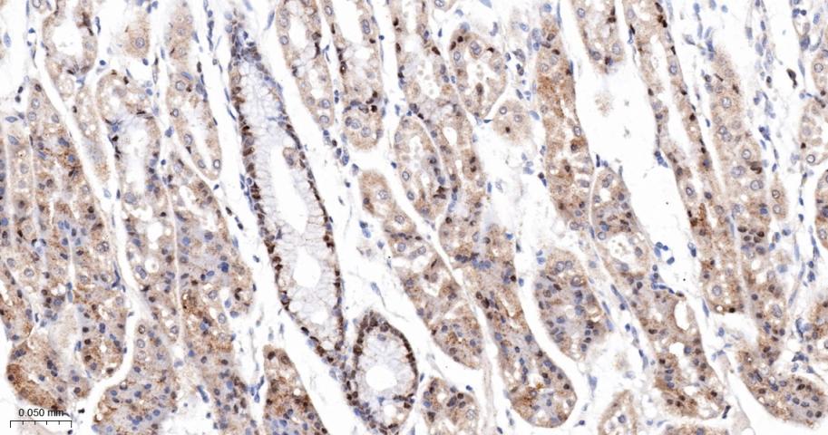 泛素结合蛋白P62重组兔单抗