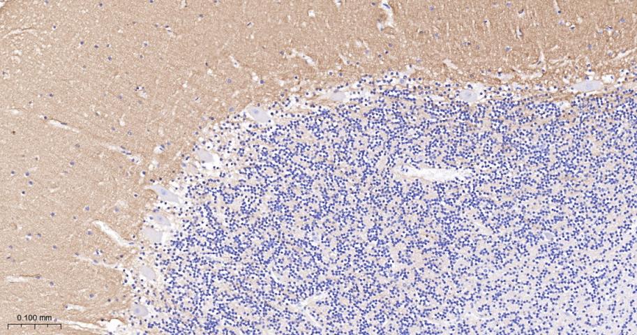 神经细胞粘附分子配体1重组兔单抗