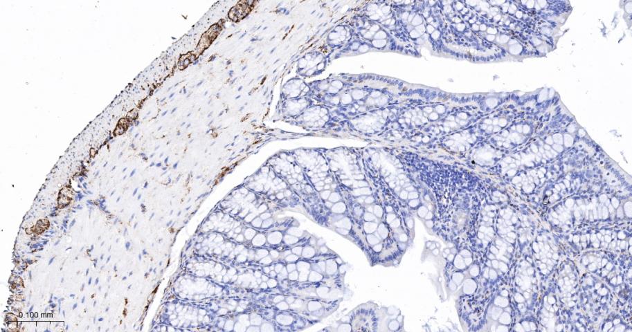突触小泡蛋白P38重组兔单抗