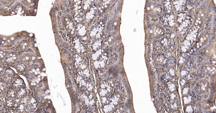 钙网蛋白重组兔单抗