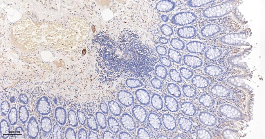 突触小泡蛋白P38重组兔单抗