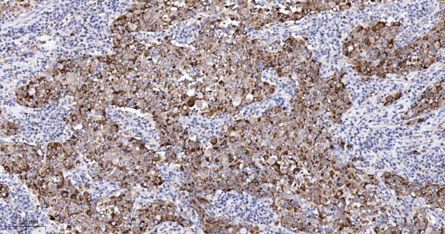 泛素结合蛋白P62重组兔单抗