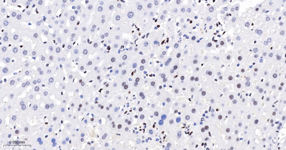 抑癌基因SNF2β重组兔单抗