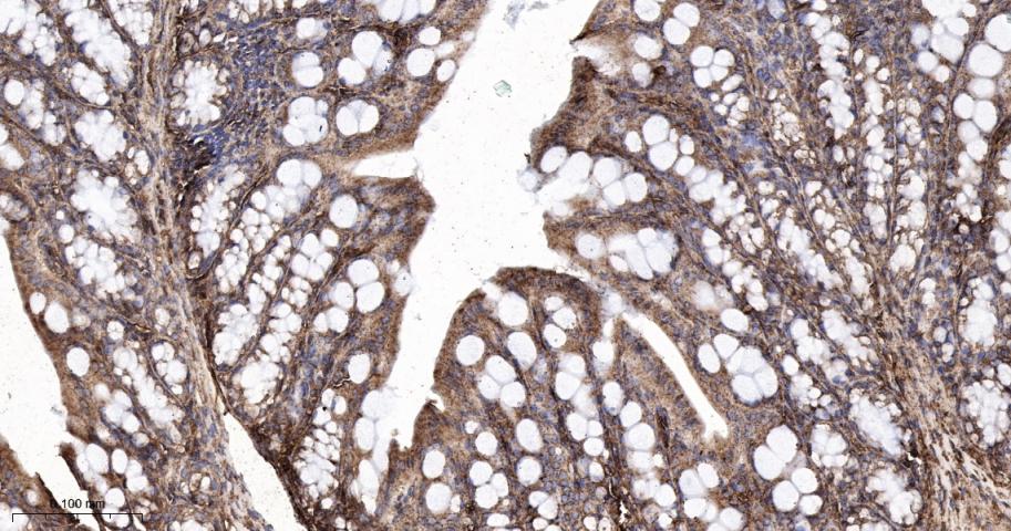 钙网蛋白重组兔单抗