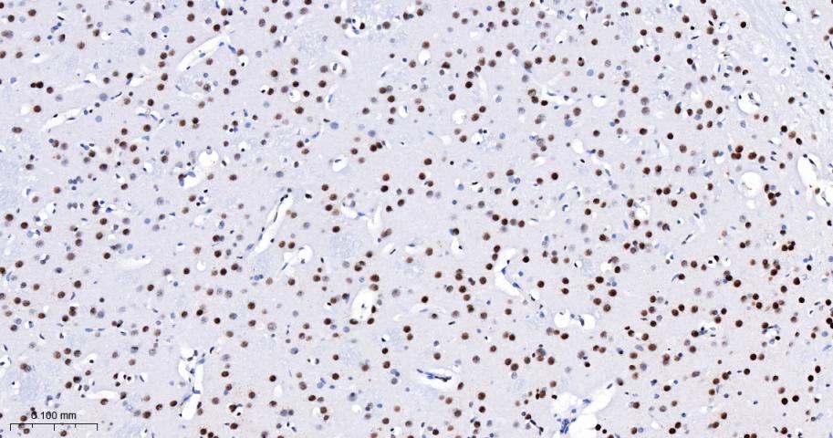 抑癌基因SNF2β重组兔单抗