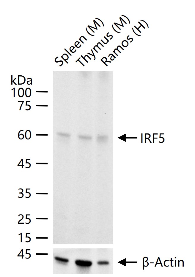 干扰素调节因子5重组兔单抗