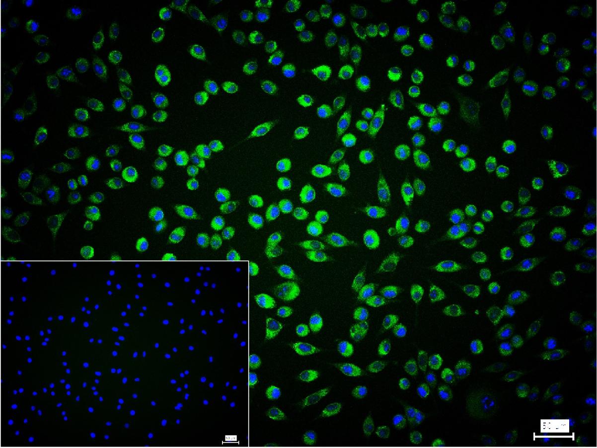 钙网蛋白重组兔单抗