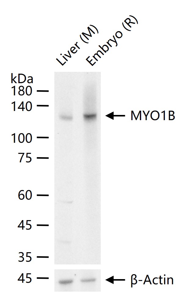 肌球蛋白1B重组兔单抗