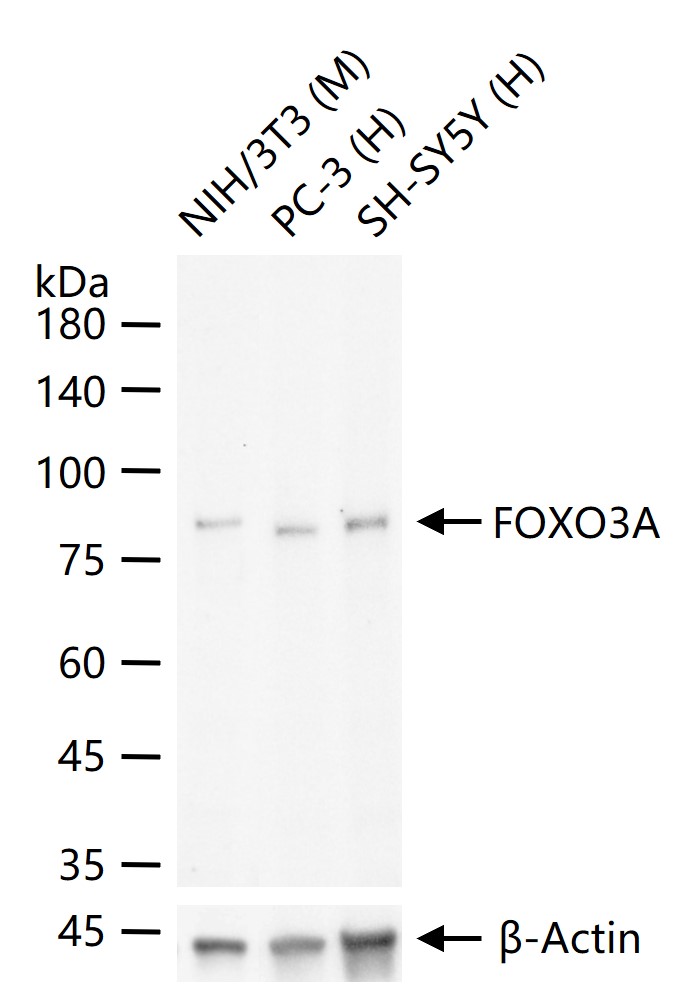 叉头蛋白O3A重组兔单抗