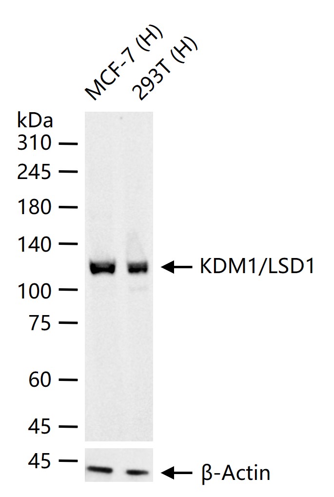 KDM1/LSD1 Recombinant Rabbit mAb (一抗) - WB,IP | Bioss