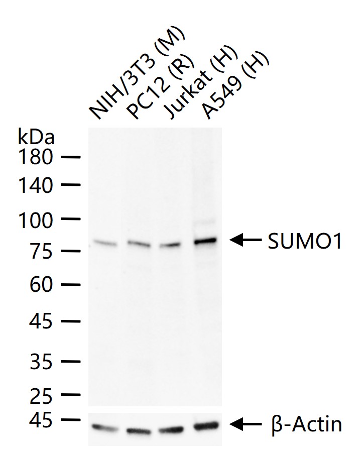 类泛素蛋白1重组兔单抗