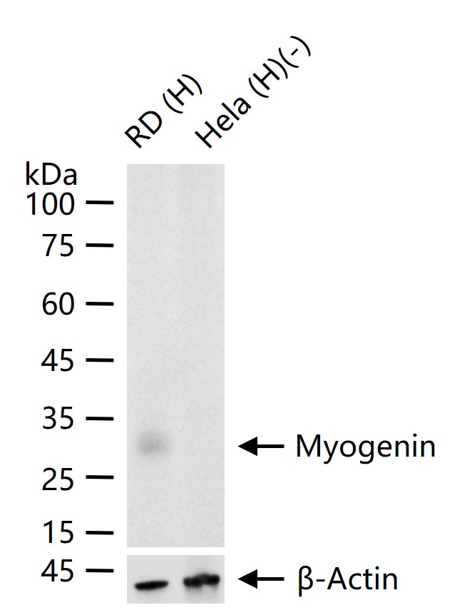 肌细胞生成素重组兔单抗