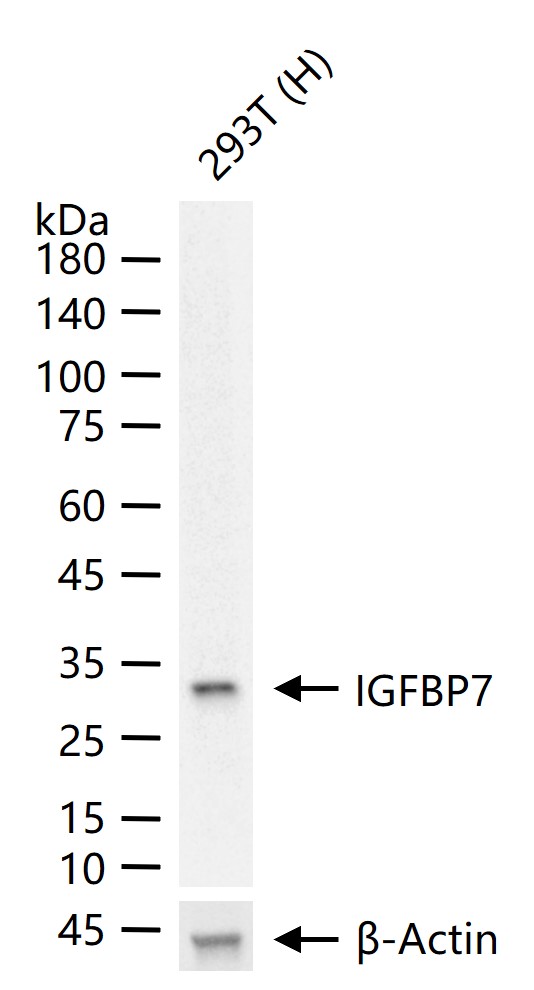 胰岛素样生长因子结合蛋白7重组兔单抗