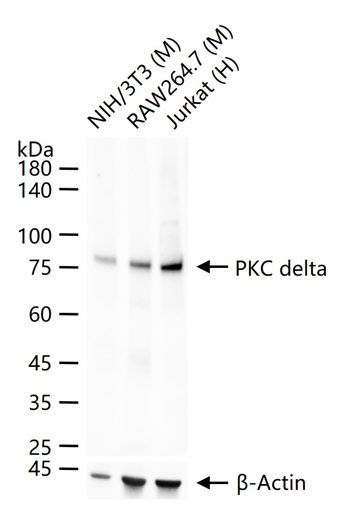 蛋白激酶C亚性D型重组兔单抗