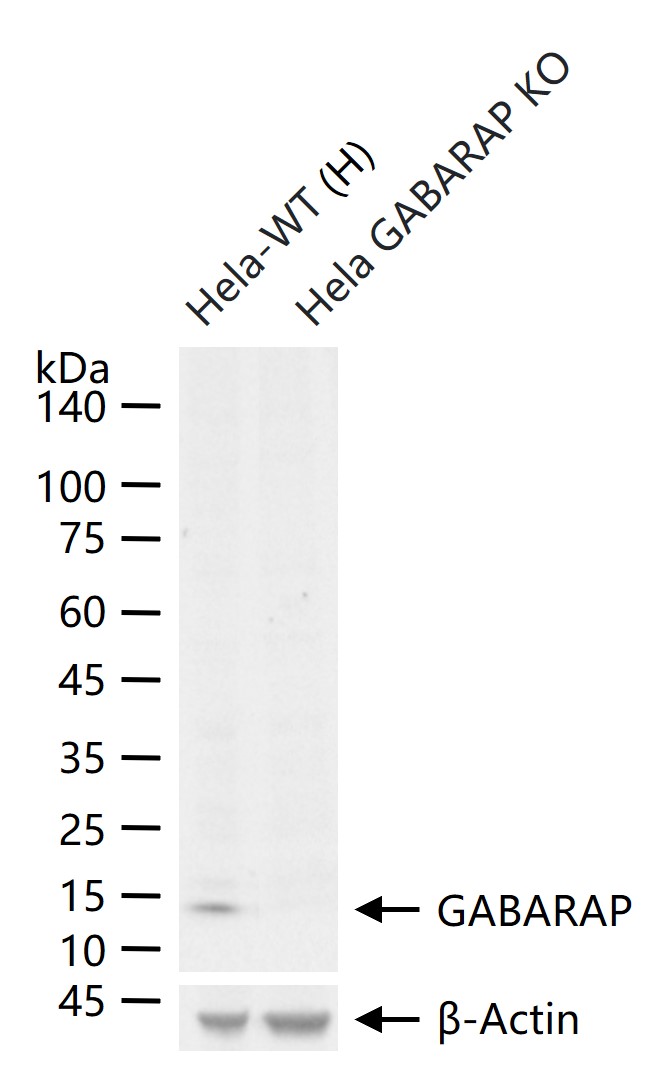 γ-氨基丁酸受体相关蛋白重组兔单抗