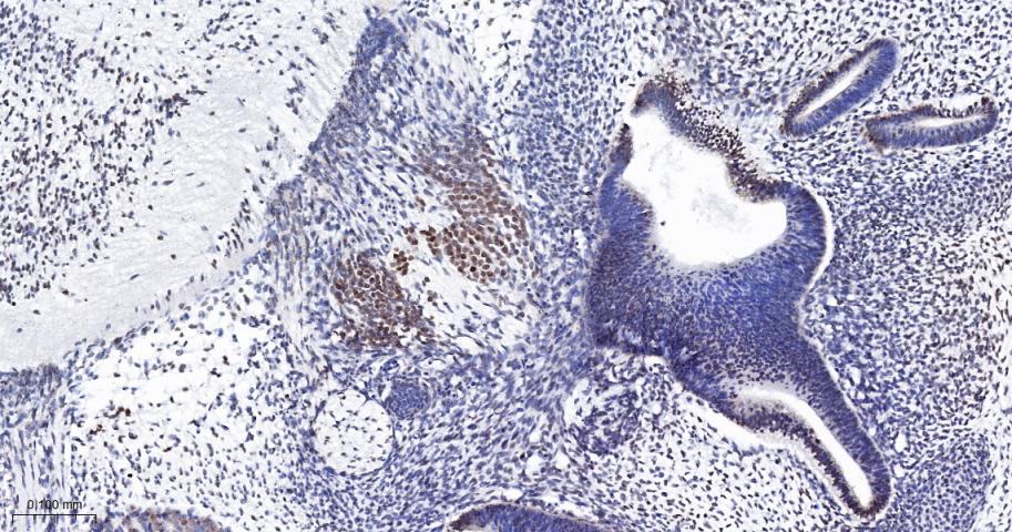 组蛋白H1.0重组兔单抗
