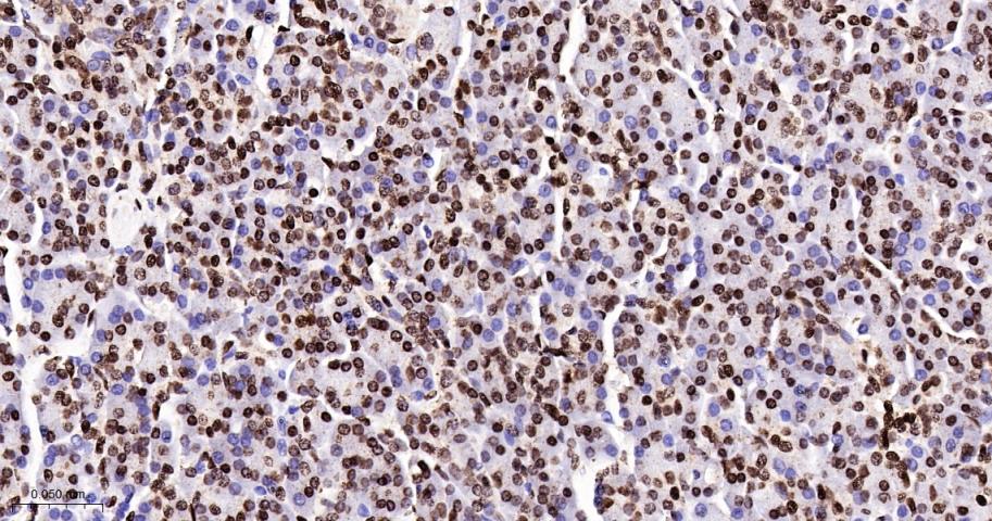 组蛋白H1.0重组兔单抗