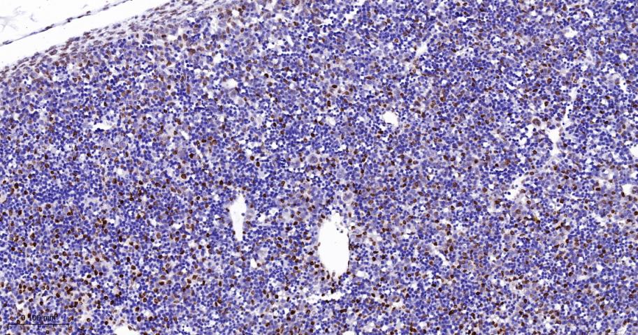 组蛋白H1.0重组兔单抗