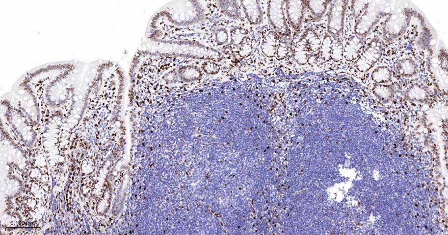 组蛋白H1.0重组兔单抗