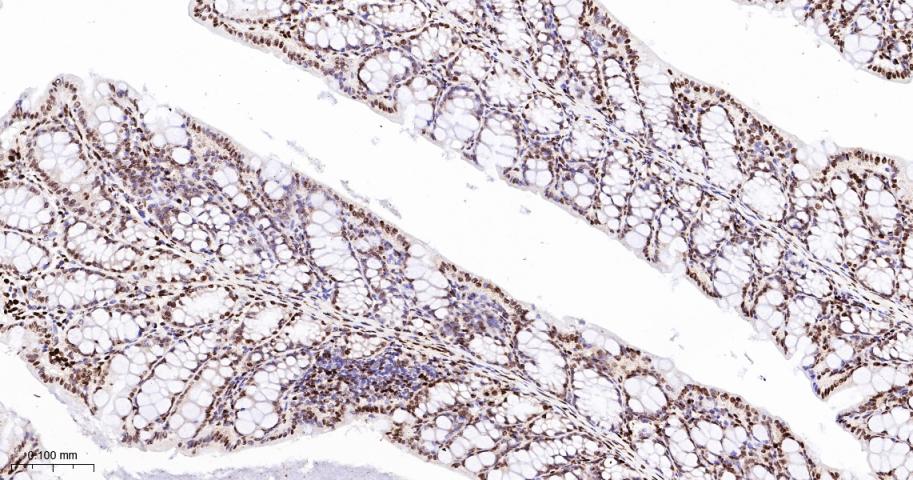 组蛋白H1.0重组兔单抗