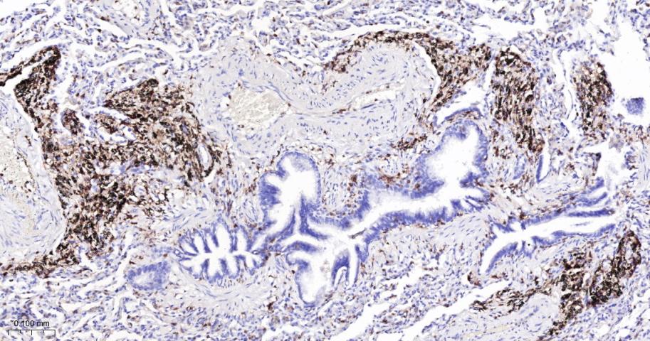 human CD18 Mouse mAb (一抗) - IHC-P,IHC-F,IF,Flow-Cyt | Bioss