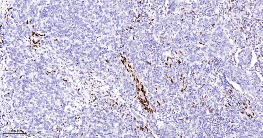 组蛋白H1.0重组兔单抗