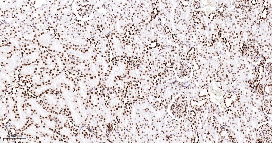 组蛋白H1.0重组兔单抗