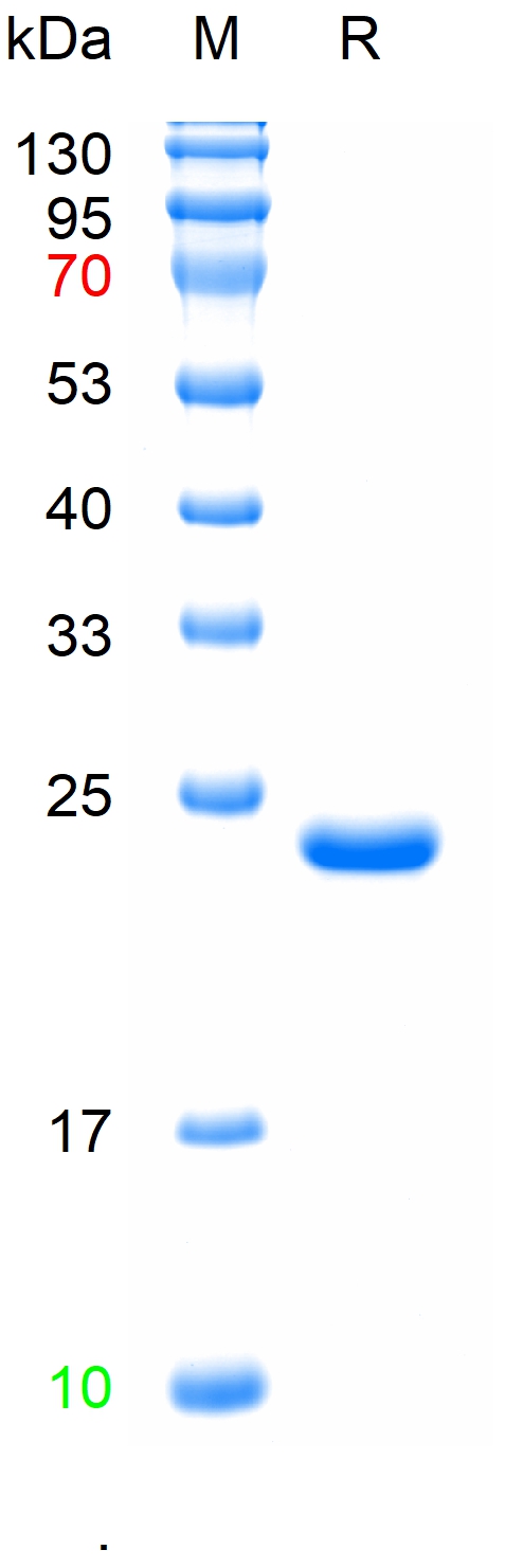 Recombinant human IL-11 protein, N-His (重组蛋白) | Bioss