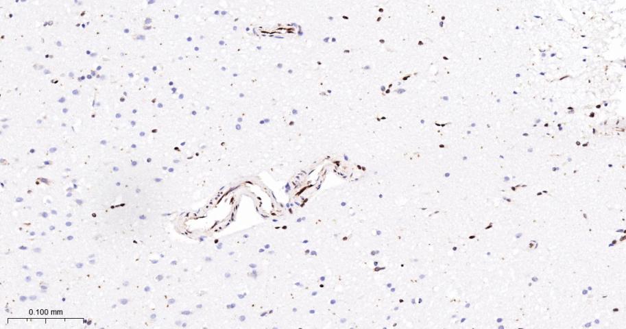 核糖核酸结合蛋白1重组兔单抗-bsm-60550R