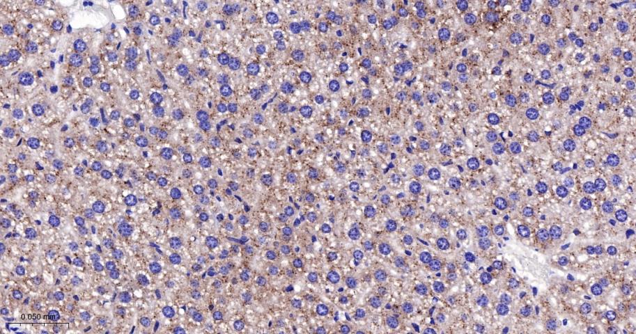 肉毒碱棕榈酰基转移酶2重组兔单抗