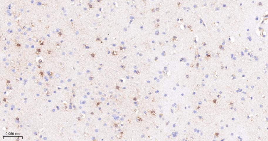 金属蛋白酶组织抑制因子-1重组兔单抗