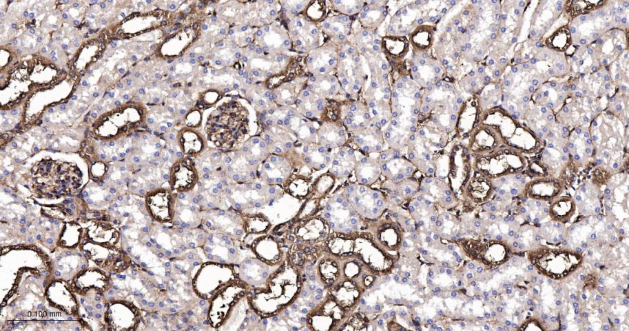 肌球蛋白调节轻链12B重组兔单抗