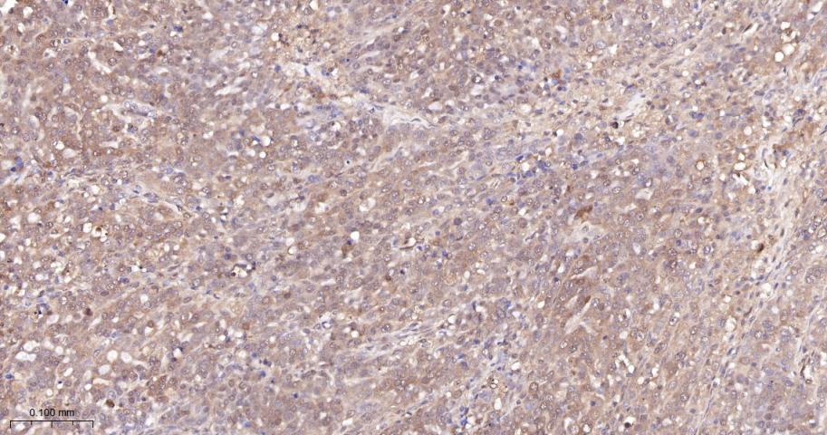 硫氧环蛋白还原酶1重组兔单抗