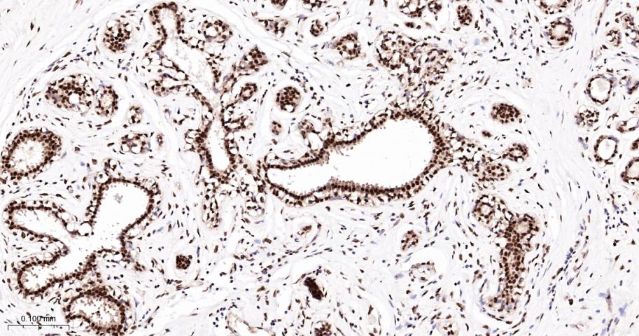 核糖核酸结合蛋白1重组兔单抗-bsm-60550R